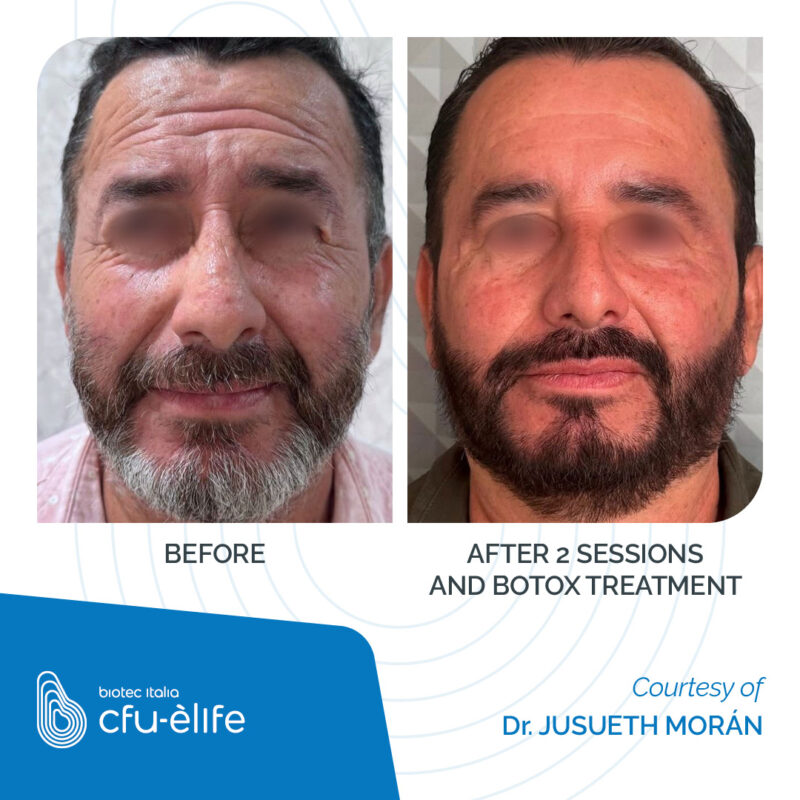 CFU Èlife - Biotec Italia